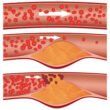 Adult Improving Cholesterol Through Structured Exercise at Private Norwest Hills District Studio