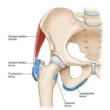 Adult Managing Hip Bursitis with Gluteal Strengthening Exercise at Private Norwest Hills District Studio