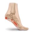 Adult Managing Plantar Fasciitis Heel Pain with Foot and Calf Strengthening at Private Norwest Hills District Studio