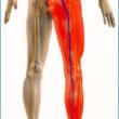 Adult managing sciatica with core and lower body strengthening at private Norwest Hills District studio