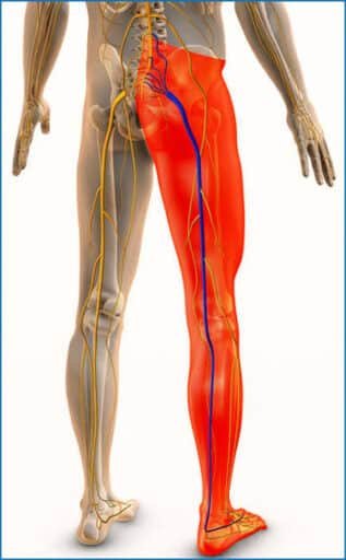 Adult Managing Sciatica with Core and Lower Body Strengthening at Private Norwest Hills District Studio